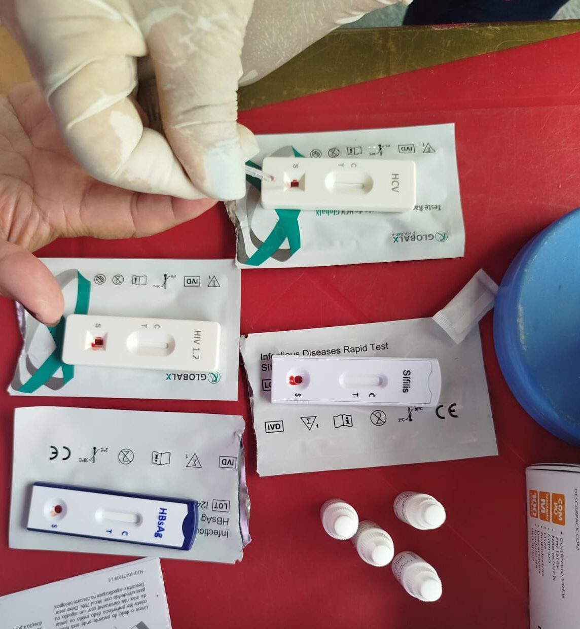 Leia mais sobre o artigo Secretaria de Saúde intensifica ações de prevenção e diagnóstico no Dia Mundial de Combate à AIDS